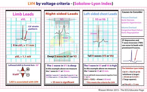 minimal voltage criteria for lvh